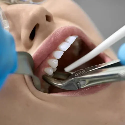 oral-surgery